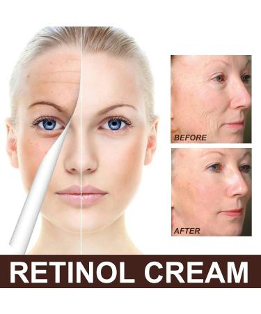 STRAIGHT Retinol facial cream retinol antiageing cream retinol moisture increasing cream retinol elevator cream retinol cream cream with hyaluronic acid reinforces and elevates the skin tint 30 g 02 - Buy Online on GoSupps.com