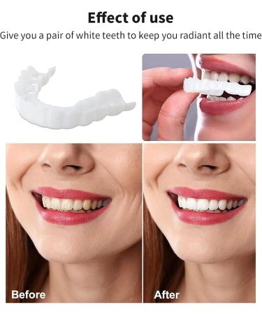 Artghjl Prostheses: Smile with Fake Teeth Veneers & Temporary Braces - Affordable Cosmetic Dental Solutions for Bad Teeth (2 Couples) - Buy Online on GoSupps.com