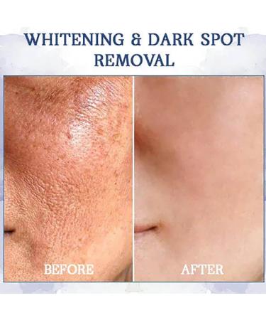 Lovilds Skin Tightener Lovilds Skin Firming Skin Firming Lovilds Advanced Firming & Wrinkle-Reducing Cream Skin Firming Rejuvenating Serum Firming Cream (1PC) - Buy Online on GoSupps.com