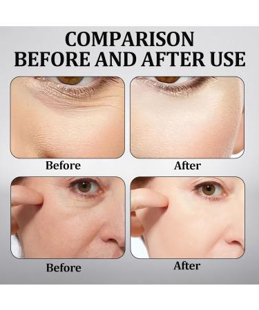 FCXQG 3 Pcs Celyn Eye Bag Cream Celyn Instant Firm Eyes Tightener 30ml Celyn Eye Cream For All Skin Types Used To Remove Dark Circles And Reduce Eye Bags - Buy Online on GoSupps.com