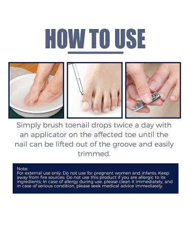 German Toenailcare Removal Paronychia Oil - Nail Renewal Liquid for Damaged Nails - Toenail Treatment Oil for Repair and Improve Toenail Health (2pcs) - Buy Online on GoSupps.com