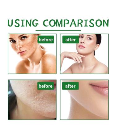Buy Pepper Ointment Plus with Collagen & Argan Oil - Browning Formula (2 PCs) | Enhance Skin Health | Global Shipping - Buy Online on GoSupps.com