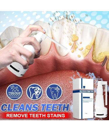 Pulv risateur dentaire Spray Calculusfree - Nettoyant pour tartre dentaire - Blanchisseur de dents - Rafra chissant buccal - liminateur de tartre (1 pi ce) 1 Pi ce. - Buy Online on GoSupps.com