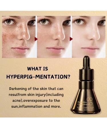 IZBEAUVO Peptide Serum Collagen Peptide Face Serum Dark Spot Remover for Face Anti Aging and Anti Wrinkle Hydrating Serum Skin Brightening Serum Correcting Melanin Repairs Skin Serums 30ml - Buy Online on GoSupps.com