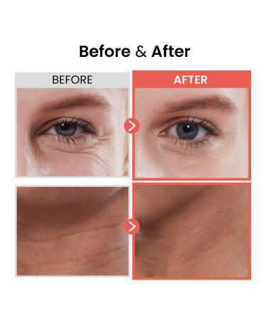 Buy The Skin House Wrinkle Supreme Serum - Fermented Red Ginseng Anti-Aging Face Serum | K-Beauty 20ml - International Shipping Available - Buy Online on GoSupps.com