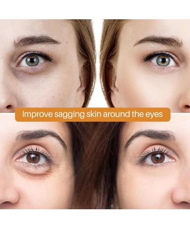 Retinol Eye Cream - Eye Cream for Dark Circles and Puffy Eyes - Ginseng Eye Cream Anti Aging - Eye Bags Remover Smooth Wrinkle Fade Fine Line - Moisture Hydrate Plump Elasticity Radiance Complexion - Buy Online on GoSupps.com