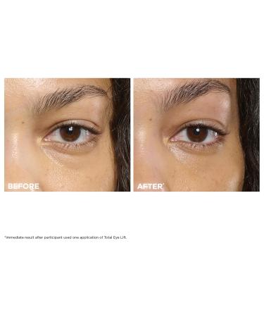 Clarins NEW Total Eye Lift | Anti Aging Eye Cream | Targets Wrinkles Crow's Feet Dark Circles and Puffiness For a Visible Eye Lift in 30 Seconds | REFILLABLE Total Eye Lift Set - Buy Online on GoSupps.com