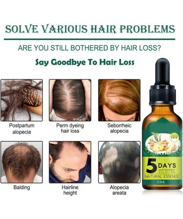 Ginger Hair Growth Set - Anti Hair Loss Shampoo & Serum for Thickening, Nourishing Scalp, Natural Baldness Treatment - Men & Women - 2 Pack (1A+1B) - Buy Online on GoSupps.com