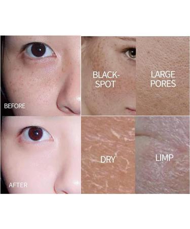 Cr me blanchissante au glutathion pour le visage cr me tonifiante hydratante et claircissante lotion claircissante anti-imperfections douce et non irritante (5pcs) - Buy Online on GoSupps.com