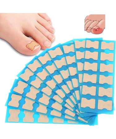 Ingrown Toenail Bandage Ingrown Toenail Correction Sticker Ingrown Toenail Correction Patch Brace Ingrown Toenail Corrector Strips Foot Care Pedicure Straightener Band Toenail Repair Tool(120 pieces) - Buy Online on GoSupps.com