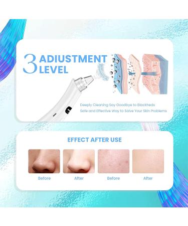 2023 Upgraded Blackhead Remover Pore Vacuum - 5 Suction Power, 5 Probes, USB Rechargeable Electric Acne Extractor for Women & Men - Off White - Buy Online on GoSupps.com