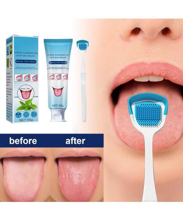 Tongue Cleaning Kit - Oral Care Gel & Brush for Breath Freshness | 2 Sets to Combat Oral Thrush & Remove Tongue Coating - Buy Online on GoSupps.com