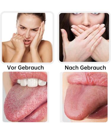 Gold Rock Stainless Steel Tongue Cleaner Set - 4 Pieces | Tongue Scraper for Adults & Kids Oral Hygiene Gift | Durable & Effective Tongue Brush - Buy Online on GoSupps.com