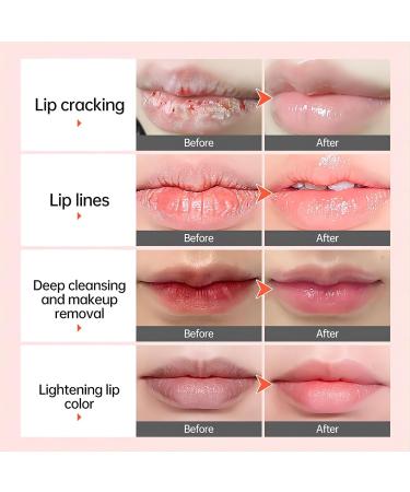 Remove Dark Lip Balm Lightening Melanin Mask Gloss Exfoliating Lip Pink Treatment Reduce Lip Lines Improve Dryness Moisturizing - Buy Online on GoSupps.com