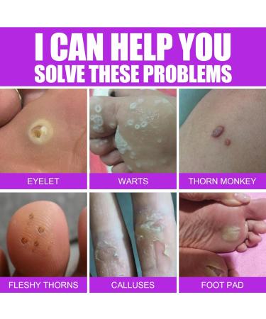 20ml Corn Removal Liquid - Callus, Corn, Wart & Skin Tag Remover for Feet - Buy Online on GoSupps.com