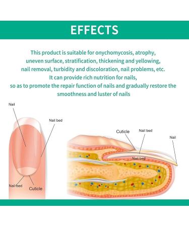 KYOSK Kerassentials Toenail Fungus Treatment Oil Kerassentials for Toenail Fungus Kerasentials Nail Treatment Repair Oil Fix & Renew Damage Nail Broken Cracked & Discolored Nails (2pcs) - Buy Online on GoSupps.com