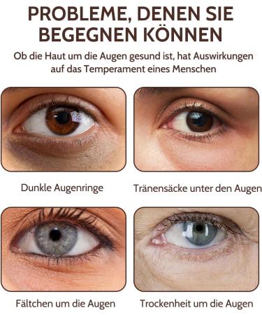 Caffeine Solution Caffeine Eye Serum Eye Cream for Dark Circles and Puffy Eyes Eye Cream for Anti-Aging Wrinkles - Buy Online on GoSupps.com