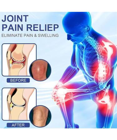 Elycura Lot de 2 cr mes pour les nerfs et la gu rison des nerfs cr me apaisante professionnelle pour soulager la douleur nerveuse ingr dients naturels soulagement efficace pour le dos le cou les 2 Pi ces. - Buy Online on GoSupps.com