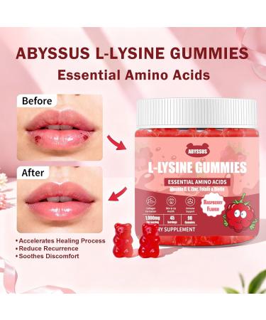 ABYSSUS Lysine Supplement Sugar Free L-Lysine 1000MG Gummies, Lysine for Women with Biotin & Folate, Skin & Immune Support, 90 Chewables - Buy Online on GoSupps.com