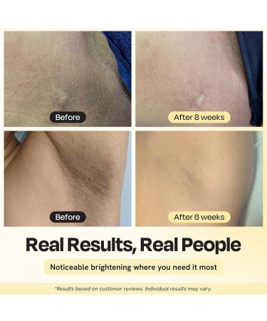 Gleamin Illuminating Intimate Serum with Vitamin C 4% Niacinamide & Alpha Arbutin Brightening Hyperpigmentation Treatment for Body - Underarm Intimates Areas & Inner Thigh Lightening 1 Fl oz - Buy Online on GoSupps.com