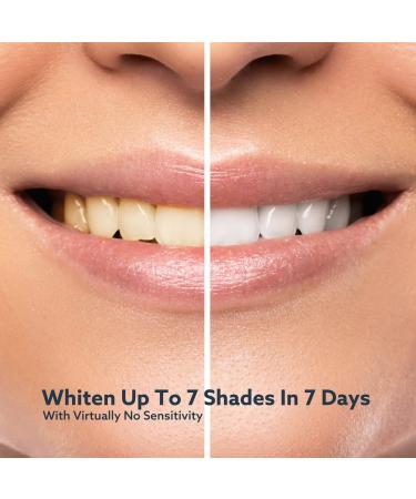 Go Smile Blu Hands-Free Teeth Whitening Toothbrush with Gum Massage and Sonic Blue Technology - White - Buy Online on GoSupps.com