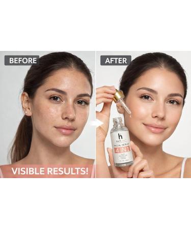 Hyaluronic Acid Face Serum with Niacinamide Deep Hydration Serum for Dry & Sensitive Skin Reduce Fine Lines Fragrance Free Paraben Free Daily Use Skin Care - Buy Online on GoSupps.com