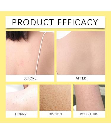 Tea Tree Body Wash Tea Tree Tinea Versicolour Body Wash with natural tea tree oil skin care for back acne folliculitis itching in the groin athletes foot and ringworm 2 - Buy Online on GoSupps.com