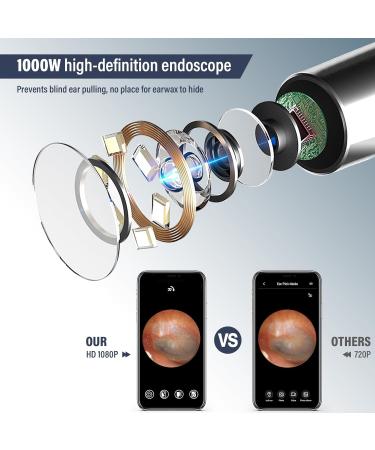 Buy Earwax Remover Otoscope - WIFI Ear Cleaner with HD Camera & 360 Wide Angle for iPhone iPad & Smartphones - International Shipping Available - Buy Online on GoSupps.com