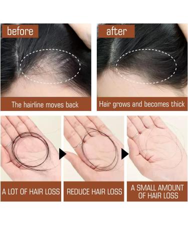  VNAKER Batana Oil Paste Batana Hair Oil 120ml Improves Shine Nourishes Dryness Smoothes Hair (1 piece) - Buy Online on GoSupps.com