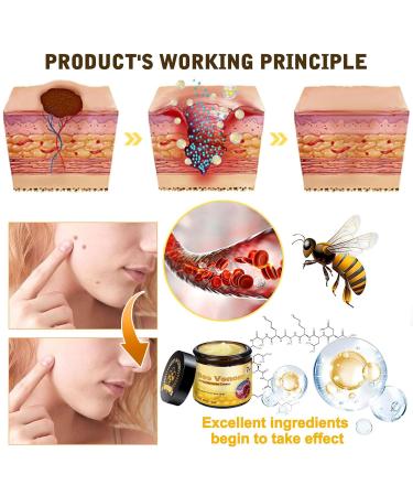 2PCS Bee Venom Comprehensive Cream Bee Venom Skin Treatment Cream Deeply Nourishes Natural Skin Moisturizer for All Skin Type - Buy Online on GoSupps.com