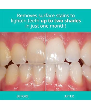 Opalescenc Teeth Whitening Toothpaste Travel Size 1 oz (2 Pack) - Fluoride Teeth Whitening Toothpaste Cool Mint Flavor Gluten-Free - Buy Online on GoSupps.com