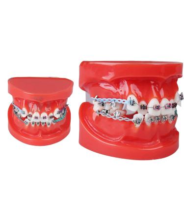 Orthodontic Teeth Model Dental Model Dental Adult Demonstration Teeth Model with Mental Brackets Orthodontic Teeth Model with Ligature Ties Red