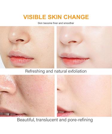 ARCHIDATE Kojic Acid Turmeric Serum Dark Spots Corrector Serum for Reduce Dark Spots Pigmentation Acne Evens Skin Tone Anti Wrinkle Fine Lines Firm Skin Moisturize and Nourish Skin - Buy Online on GoSupps.com