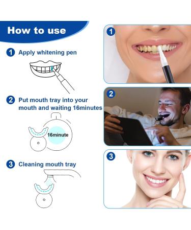 Douceur Teeth Whitening Kit - Professional 32X LED Whitener with 3 Non-Sensitive Gel Pens for Quick and Gentle Smile Whitening - Buy Online on GoSupps.com