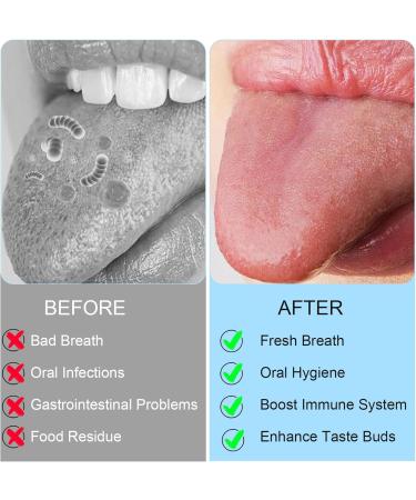 5-in-1 Tongue Cleaner & Scraper | Stainless Steel Tongue Claser for Fresh Breath | Combat Bad Breath Effectively - Buy Online on GoSupps.com