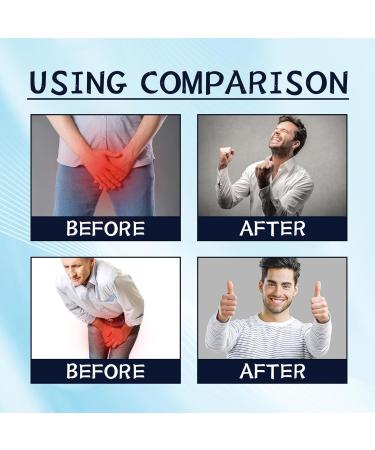 Prostate Health Cream - 3x20g Nutritional Supplements for Men | Soothing Absorbing Paste - Buy Online on GoSupps.com