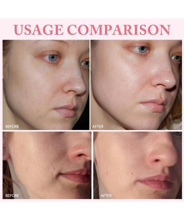 PDRN Pink One Day Serum Hydrating Facial Serum with 99% Salmon DNA Collagen Glutathione Elastin Complex for Intense Moisture Firming Repairing & Moisturizing Face Essence 0.05fl*30e - Buy Online on GoSupps.com