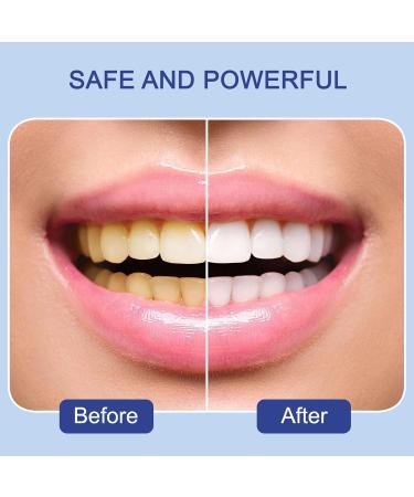 3 Pieces Teeth Whitening Pen - Abbey Professional Formula for Effective Stain Removal - Buy Online on GoSupps.com