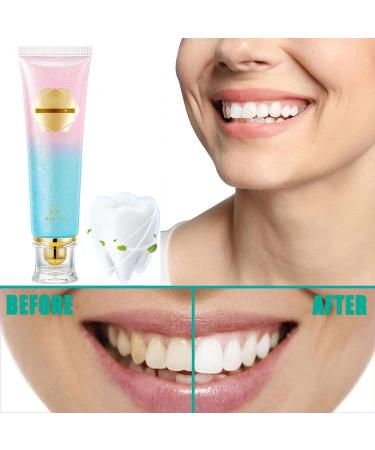 Niacinamide Whitening Toothpaste Anti-Stain Whitening Toothpaste Oral Cleaning to Remove Tooth Stains and Bad Breath (2pcs) - Buy Online on GoSupps.com