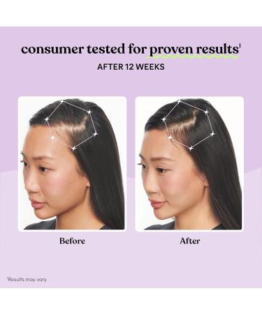 Lemme Grow Hair Growth Supplement for Women Clinically Proven Keratin Complex for Visibly Thicker Hair and Scalp Coverage Reduced Shedding Nourish Thinning Hair - 1 Month Supply - Buy Online on GoSupps.com