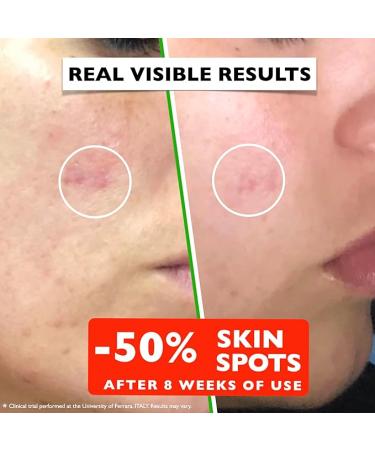 2oz. Organic Vitamin C Serum & Hyaluronic Acid for Face, Neck, Eyes - Brighten and Hydrate Your Skin - Buy Online on GoSupps.com