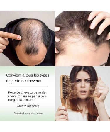  Yanayi Root Activating Shampoo | Fortifying for Volume and Growth - 220ml Clarifying Root Activating Shampoo for Fine Thin Curly Damaged Dry Sensitive Hair Daily Use - Buy Online on GoSupps.com