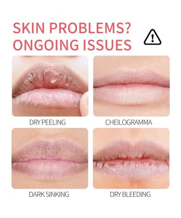 24 Packs Fruit Flavored Lip Balm set Nourishing & Lip Balm Fruit Sets with Olive Oil Peach Jojoba Oil Lip Care for Dry Peeling Dull Lip Lines Moisturizing and Repairing Lipstick 0.2oz Strawberry & Blueberry & Lemon  - Buy Online on GoSupps.com