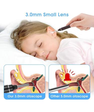 Earwax Remover Tool MYPIN 1080P HD Wireless Otoscope Ear Cleaner Kit Ear Wax Removal Kit Camera Ear Drops for Wax Ear Camera for iPhone/iPad/Android Red - Buy Online on GoSupps.com