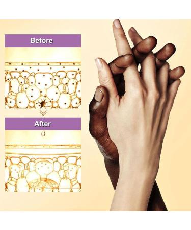 Dark Knuckle Whitening Serum Whitening Cream Knee Whitening Serum Joint Whitening Essential Oil Joint Brightening Cream Skin Lightening Serum for Und r rms Elbows Knees - Buy Online on GoSupps.com