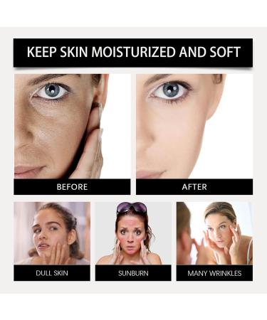 Aloe Vera Skin Care Products Gel Aloe Vera Lotion Sun Burn Recovery Cream After Sun Body Lotion Vitamin C + Hyaluronic Acid Sun Damaged Skin Repair Moisturizing Cream (1) - Buy Online on GoSupps.com