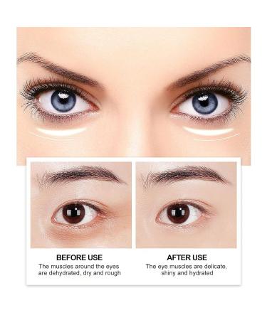HOKILAW Eelhoe Instant Firming Eye Cream - Under Eye Bag Removal and Dark Circle Treatment - 3pcs Set - Buy Online on GoSupps.com
