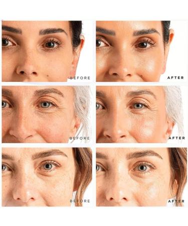 Aloe Vera Face Cream - Face Moisturizer For Women - Hydrating Face Moisturiser For All Skin Types -Night Cream for Women Anti Aging - Good For Anti-Wrinkle Acne Soothing and Moisturizing - Buy Online on GoSupps.com