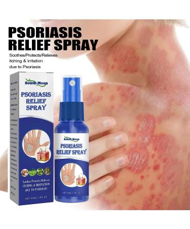 HEKEWER South Moon Psoriasis Repair Spray - Professional Herbal Treatment for Skin Plaque Psoriasis - Buy Online on GoSupps.com