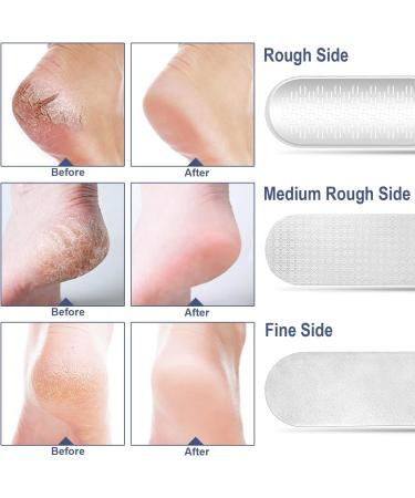 Foldable 3-in-1 Callus Remover for Feet | Professional Stainless Steel Foot Scrubber | Hard Dead Skin Remover & Grater | Wet/Dry Use | Easy to Carry - Black - Buy Online on GoSupps.com
